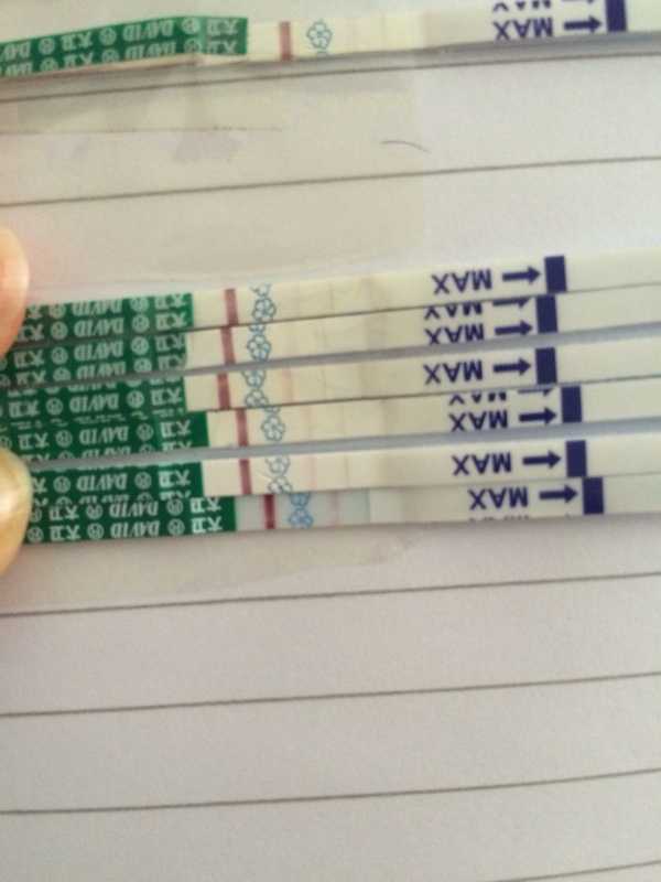 始基子宫：症状、诊断、治疗与助孕方案深度解析